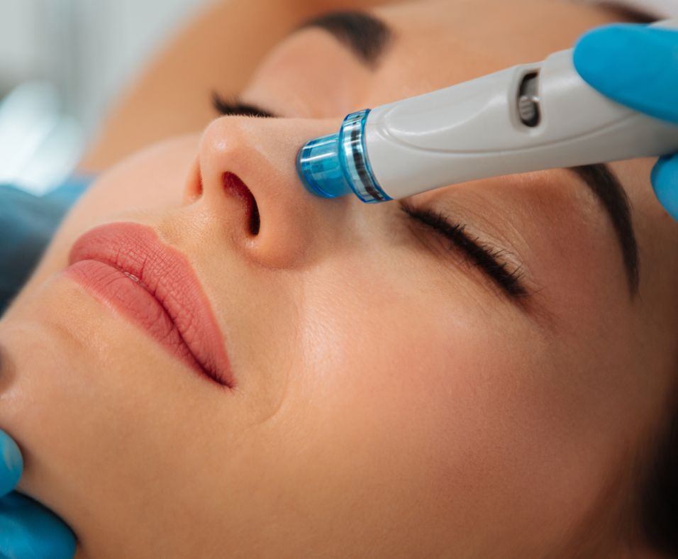 HydraFacial sejas kopšanas procedūra